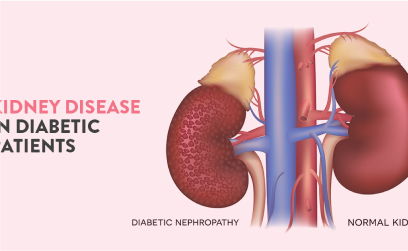 Simple Steps to Optimal Health